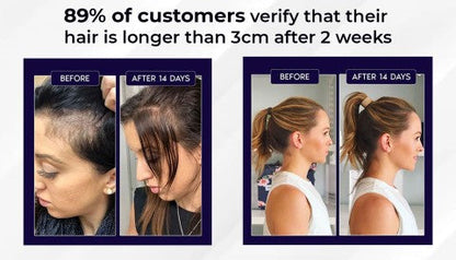 🌿LAST DAY PROMOTION - 70% OFF🌿 HZA™ Natural Hair Regrowth Spray