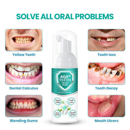 AQA™ Teeth Mouthwash - Solve all Oral Problems