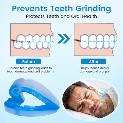 Slimoly™ | Anti-Snoring & Anti-Grinding Teeth Protector
