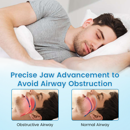 Slimoly™ | Anti-Snoring & Anti-Grinding Teeth Protector