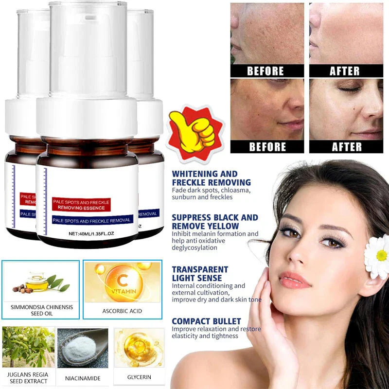 ⚡5-second brightening rescue: Dark spots disappear, blemishes fade, and skin becomes radiant! Vitamin C Whitening Freckles ESSENCE