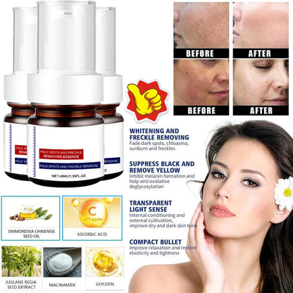 ⚡5-second brightening rescue: Dark spots disappear, blemishes fade, and skin becomes radiant! Vitamin C Whitening Freckles ESSENCE